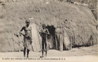 A native boy suffering from small-pox and his house. Mombasa B.E.A.